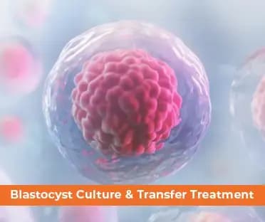 Blastocyst Transfer Procedure with Text "Blastocyst culture and transfer Treatment" - Mobile Banner Image