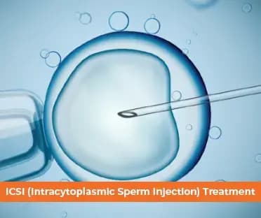 ICSI Procedure with text "ICSI (Intracytoplasmic Sperm Injection) Treatment" - Mobile Banner Image