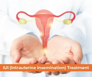 IUI Procedure with text "IUI (Intrauterine Insemination) Treatment" - Mobile Banner Image