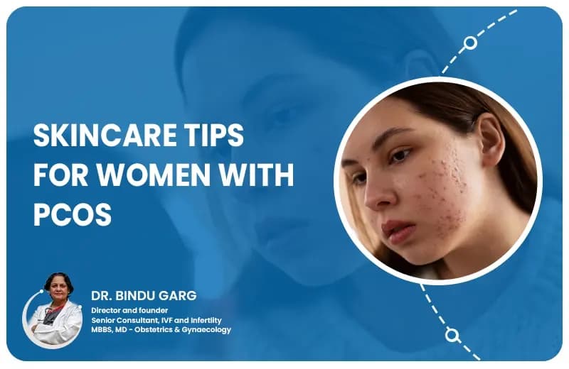 Skincare Tips for Women with PCOS