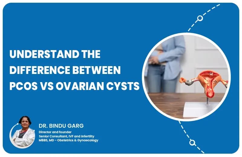 The Difference Between PCOS vs Ovarian Cysts