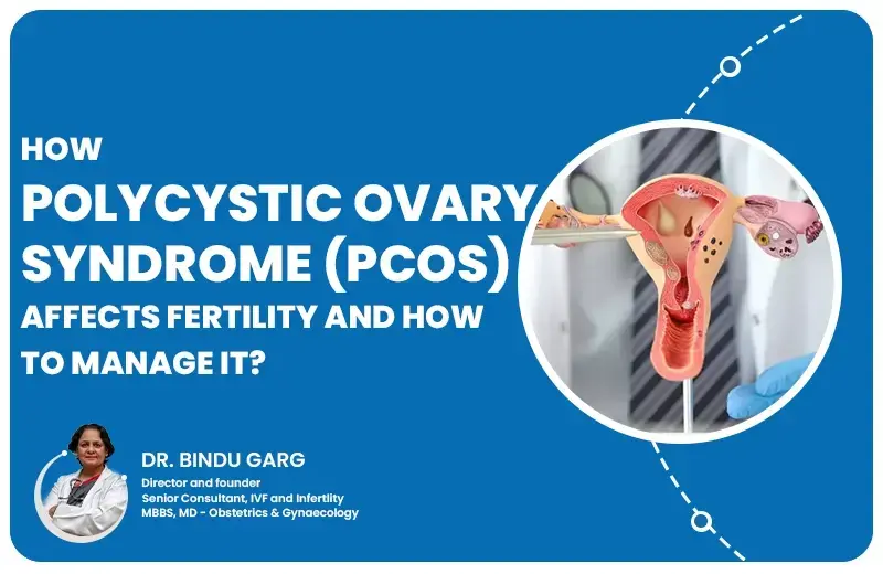 How Polycystic Ovary Syndrome (PCOS) Affects Fertility and How to Manage It